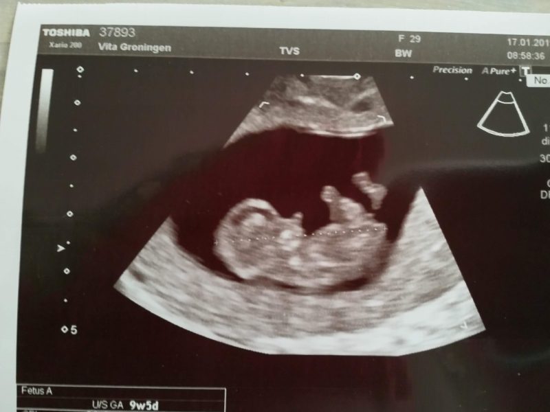 minicamper-baby-zwanger-geboorte