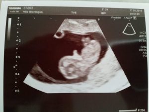 minicamper-baby-zwanger-geboorte